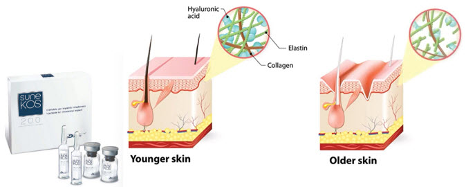 Sunekos Help in Deal with Increased Skin Turnover